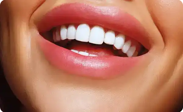 Hollywood Smile