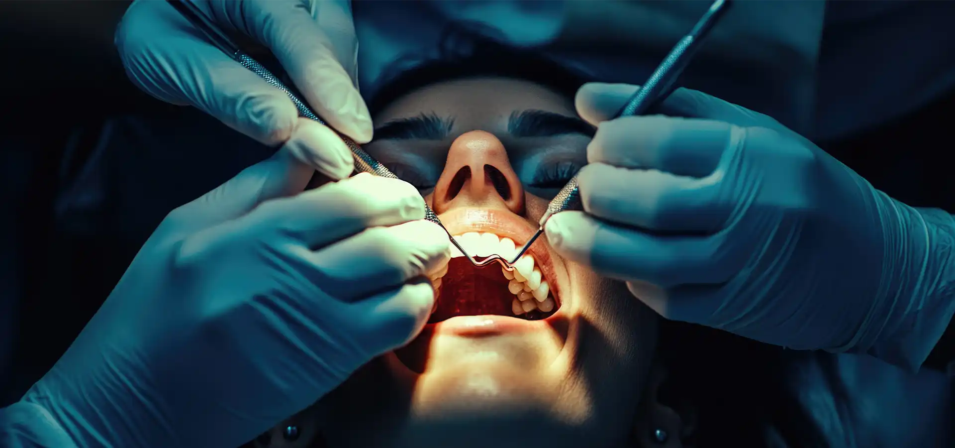 Tooth Extraction in Istanbul, Turkey